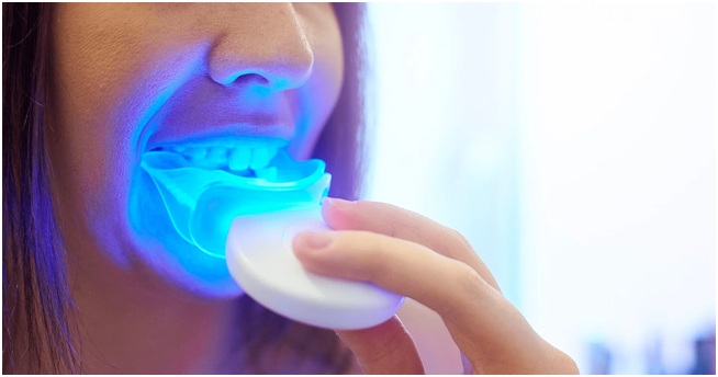 Teeth whitening kit