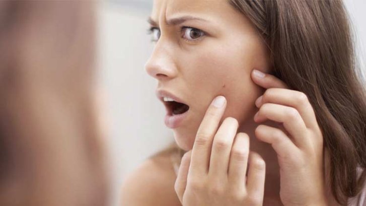 Reduce Irritation When Using Benzoyl Peroxide Wash