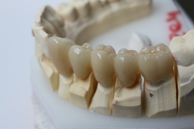 How are zirconia crowns made?