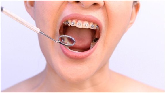 Qualities to Look for in the Best Orthodontists (1)