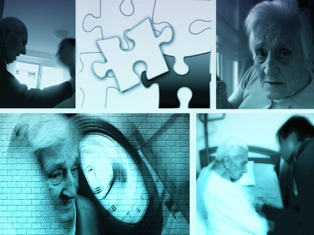 Treating Alzheimer’s in Seniors