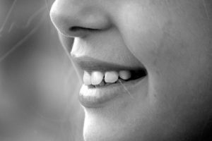 Veneers in Turkey