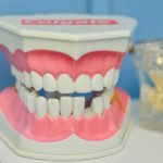 Dentures Implant