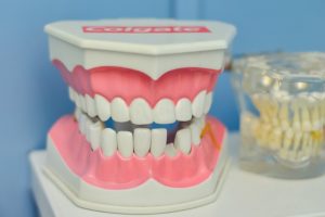 Dentures Implant