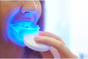 Teeth whitening kit