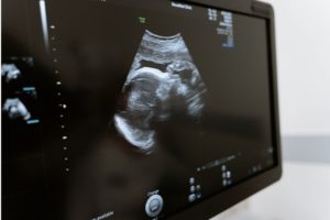 Surrogacy Legal in Cancun