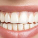 Health Benefits Of Straighter Teeth