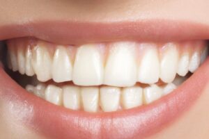 Health Benefits Of Straighter Teeth
