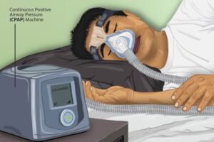 Perth CPAP Services