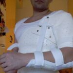 Shoulder Surgery Types and Technologies