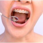 Qualities to Look for in the Best Orthodontists (1)