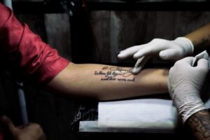 Tattoo Removal for Brides, Grooms