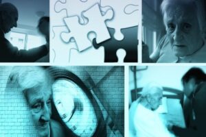 Treating Alzheimer’s in Seniors